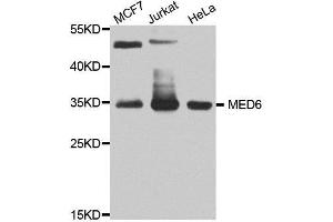 Western blot analysis of extracts of various cell lines, using MED6 antibody. (MED6 抗体  (AA 27-246))