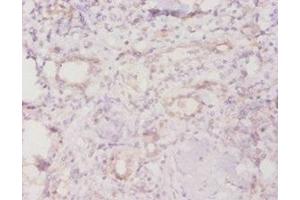 Immunohistochemistry (IHC) image for anti-TROVE Domain Family, Member 2 (TROVE2) (AA 3-535) antibody (ABIN7142715)
