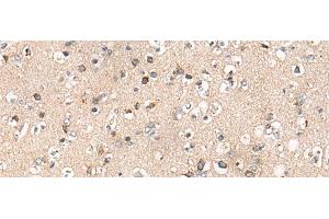 Immunohistochemistry of paraffin-embedded Human brain tissue using C14orf2 Polyclonal Antibody at dilution of 1:60(x200) (C14orf2 抗体)