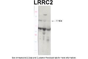 WB Suggested Anti-TP53 Antibody Titration: 0. (LRRC2 抗体  (N-Term))