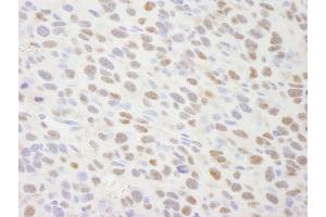 Immunohistochemistry (IHC) image for anti-Tripartite Motif Containing 24 (TRIM24) (AA 700-750) antibody (ABIN7448834) (TRIM24 抗体  (AA 700-750))