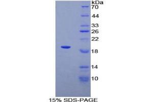 SDS-PAGE analysis of Human ADRA1A Protein. (alpha 1 Adrenergic Receptor 蛋白)