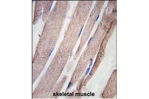 Formalin-fixed and paraffin-embedded human skeletal muscle tissue reacted with PHPT1 Antibody (C-term), which was peroxidase-conjugated to the secondary antibody, followed by DAB staining. (PHPT1 抗体  (N-Term))