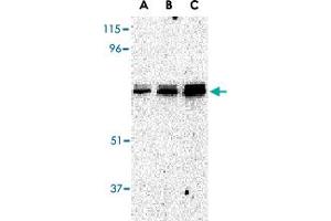 Western blot analysis of EIF2AK2 in A-431 whole cell lysate with EIF2AK2 polyclonal antibody  at (A) 0.