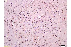 Formalin-fixed and paraffin embedded rat brain labeled with Anti-Phospho-MAPKAPK2(Thr334) Polyclonal Antibody, Unconjugated (ABIN743693) at 1:200 followed by conjugation to the secondary antibody and DAB staining (MAPKAP Kinase 2 抗体  (pThr334))