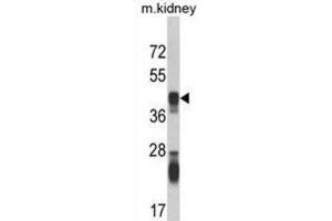 Western Blotting (WB) image for anti-Argininosuccinate Synthase 1 (ASS1) antibody (ABIN3002823) (ASS1 抗体)