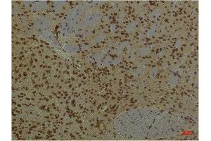 Immunohistochemistry (IHC) analysis of paraffin-embedded Mouse Brain Tissue using HIF-1 beta/ARNT Mouse Monoclonal Antibody diluted at 1:200. (ARNT 抗体)