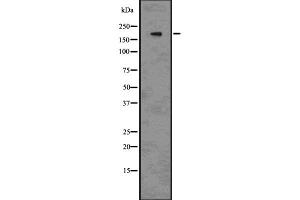 Western blot analysis of BRG1 using 293 whole cell lysates (SMARCA4 抗体  (N-Term))