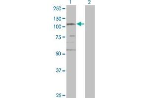 Western Blot analysis of SMC3 expression in transfected 293T cell line by CSPG6 monoclonal antibody (M02), clone 2F11. (SMC3 抗体  (AA 711-810))