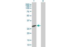 Western Blot analysis of CCBE1 expression in transfected 293T cell line by CCBE1 MaxPab polyclonal antibody. (CCBE1 抗体  (AA 1-215))
