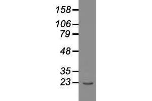 Western blot analysis of 35 µg of cell extracts from human Liver carcinoma (HepG2) cells using anti-AK1 antibody. (Adenylate Kinase 1 抗体)
