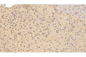 Immunohistochemistry (IHC) image for anti-Tumor Necrosis Factor Receptor Superfamily, Member 21 (TNFRSF21) (AA 406-605) antibody (ABIN7437356)