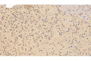 Detection of TNFRSF21 in Mouse Cerebrum Tissue using Polyclonal Antibody to Tumor Necrosis Factor Receptor Superfamily, Member 21 (TNFRSF21) (TNFRSF21 抗体  (AA 406-605))