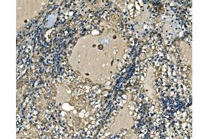 IHC analysis of ATP6V1A using anti-ATP6V1A antibody (ABIN7599916).