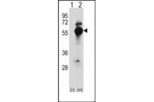 Western blot analysis of DARS (arrow) using DARS1 Antibody (N-term) Cat. (DARS 抗体  (N-Term))