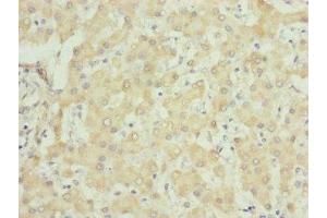 Immunohistochemistry of paraffin-embedded human liver tissue using ABIN7149102 at dilution of 1:100 (UQCRC1 抗体  (AA 156-480))