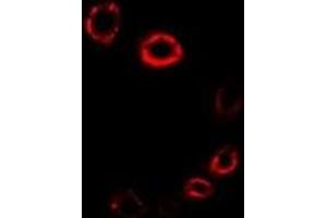 Immunofluorescent analysis of HMGCR staining in A549 cells. (HMGCR 抗体)