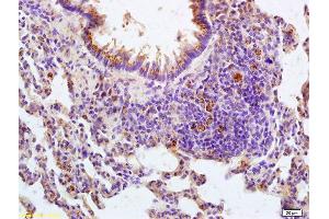 Formalin-fixed and paraffin embedded rat lung tissue labeled with Anti-IL-22R Polyclonal Antibody, Unconjugated (ABIN748178) at 1:200 followed by conjugation to the secondary antibody and DAB staining (IL22 Receptor alpha 1 抗体  (AA 41-150))