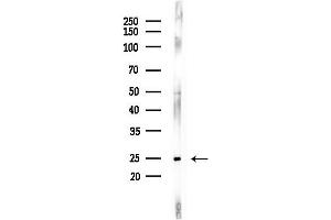 Western blot analysis of lysates from LoVo cells(heat-shock,45 min treatment), using TSN Antibody at 1/1000 dilution.