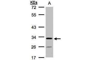 WB Image Sample(30 ug whole cell lysate) A:H1299 10% SDS PAGE antibody diluted at 1:1000 (C4orf19 抗体)