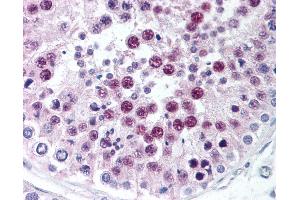 Anti-SIRT1 antibody IHC of human testis. (SIRT1 抗体  (C-Term))