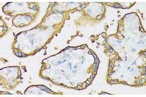 Immunohistochemistry of paraffin-embedded Human placenta using ALPP Polyclonal Antibody at dilution of 1:100 (40x lens). (PLAP 抗体)