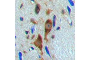 Immunohistochemical analysis of Histone Deacetylase 6 (pS22) staining in human brain formalin fixed paraffin embedded tissue section.