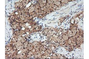 Image no. 5 for anti-Mitogen-Activated Protein Kinase Kinase 1 (MAP2K1) antibody (ABIN1499388) (MEK1 抗体)