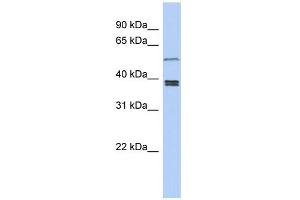 WB Suggested Anti-SS18L1 Antibody Titration: 0. (SS18L1 抗体  (Middle Region))