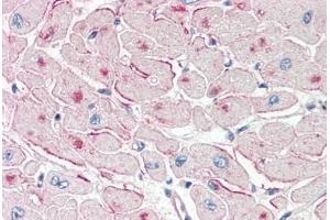 Human Heart (formalin-fixed, paraffin-embedded) stained with PNPLA2 antibody ABIN337131 at 2. (PNPLA2 抗体  (AA 68-79))