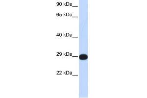WB Suggested Anti-PPP4C Antibody Titration: 0. (PPP4C 抗体  (Middle Region))