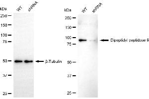 Western blotting analysis using dipeptidyl peptidase 9 antibody (ABIN7798347).