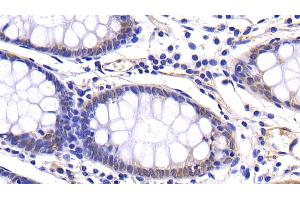 Detection of MMP7 in Human Colon Tissue using Polyclonal Antibody to Matrix Metalloproteinase 7 (MMP7) (MMP7 抗体  (AA 1-267))