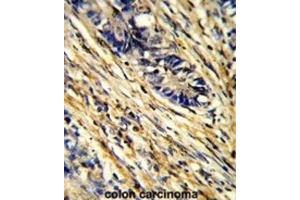 Immunohistochemistry (IHC) image for anti-14-3-3 gamma (YWHAG1) antibody (ABIN3001731) (14-3-3 gamma 抗体)
