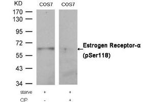 Western blot analysis of extracts from COS7 cells, treated with starve or calf intestinal phosphatase (CIP), using Estrogen Receptor-α (Phospho-Ser118) Antibody. (Estrogen Receptor alpha 抗体  (pSer118))