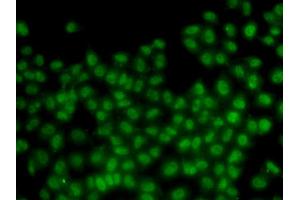Immunofluorescence analysis of HeLa cells using ID3 antibody. (ID3 抗体)
