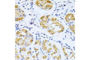 Immunohistochemistry of paraffin-embedded human stomach using CYP2E1 antibody (ABIN3023078, ABIN3023079, ABIN3023080 and ABIN6219379) at dilution of 1:100 (40x lens). (CYP2E1 抗体  (AA 234-493))
