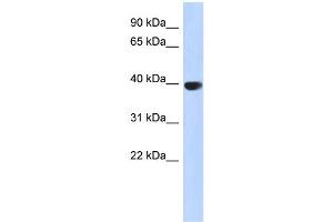 WB Suggested Anti-AURKC Antibody Titration: 0. (Aurora Kinase C 抗体  (Middle Region))