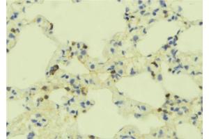 ABIN6273355 at 1/100 staining Mouse lung tissue by IHC-P. (GEM 抗体  (N-Term))