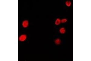 Immunofluorescent analysis of HRP2 staining in A549 cells. (HDGFRP2 抗体)