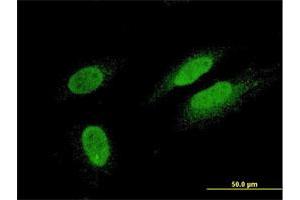 Immunofluorescence of monoclonal antibody to TTN on HeLa cell. (Titin 抗体  (AA 1-110))