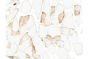 Immunohistochemistry (IHC) image for anti-Myoglobin (MB) antibody (ABIN7795606) (Myoglobin 抗体)
