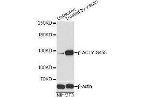 Western blot analysis of extracts of NIH/3T3 cells,using Phospho-ACLY-S455 antibody. (ACLY 抗体  (pSer455))