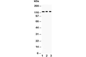Western blot testing of PLD1 antibody and Lane 1:  mouse heart;  2: 22RV1;  3: HeLa;  Predicted size: 124KD;  Observed size: 124KD (PLD1 抗体  (AA 1-330))