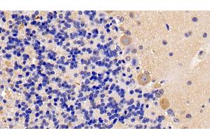Detection of OSMR in Rat Cerebellum Tissue using Polyclonal Antibody to Oncostatin M Receptor (OSMR)