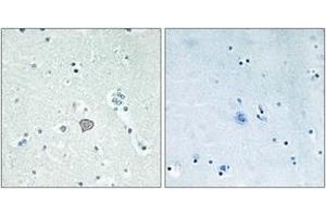 Immunohistochemistry analysis of paraffin-embedded human brain tissue, using ADORA2A Antibody. (Adenosine A2a Receptor 抗体  (AA 321-370))
