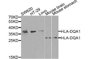 Western blot analysis of extracts of various cells, using HLA-DQA1 antibody. (HLA-DQA1 抗体)