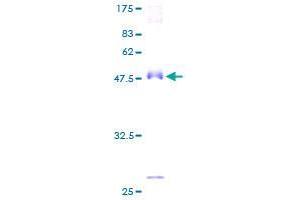 AMACR Protein (AA 1-198) (GST tag)