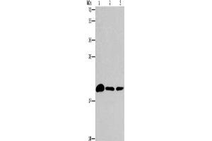 Gel: 15 % SDS-PAGE, Lysate: 40 μg, Lane 1-3: Mouse brain tissue, 231 cells, A375 cells, Primary antibody: ABIN7189902(ARL3 Antibody) at dilution 1/433, Secondary antibody: Goat anti rabbit IgG at 1/8000 dilution, Exposure time: 2 minutes (ARL3 抗体)