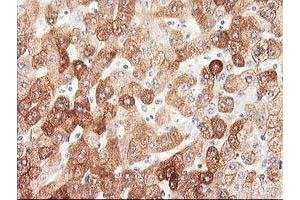 Immunohistochemical staining of paraffin-embedded Human liver tissue using anti-NHEJ1 mouse monoclonal antibody. (NHEJ1 抗体)